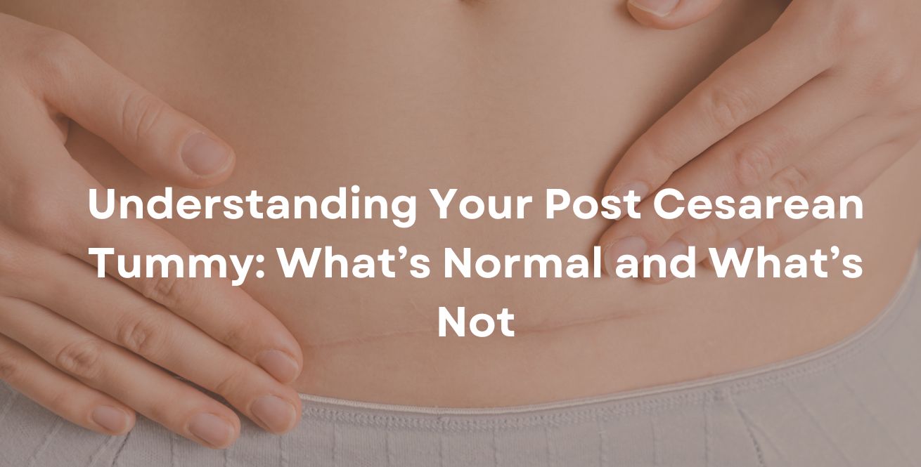 Understanding Your Post Cesarean Tummy: What’s Normal and What’s Not