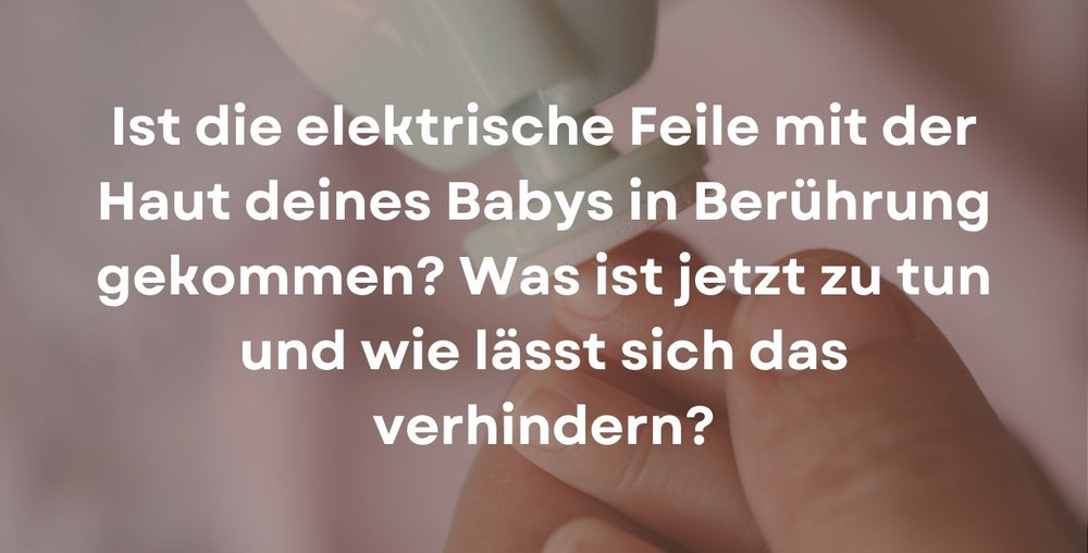 Ist die elektrische Feile mit der Haut deines Babys in Berührung gekommen? Was ist jetzt zu tun und wie lässt sich das verhindern?